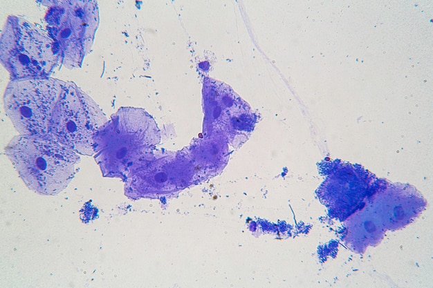 Photo purple colored parasites under the microscope