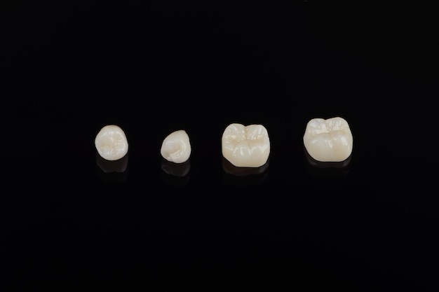 Qualified anatomic ceramic and zirconia crowns of human teeth close up macro isolated on black