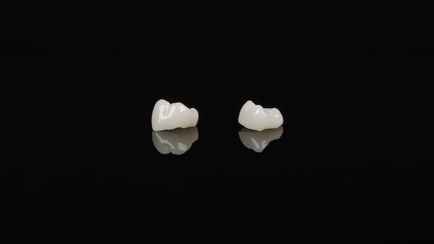 Qualified anatomic ceramic and zirconia crowns of human teeth close up macro isolated on black