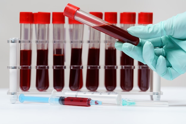 Foto rack di provette di sangue per il test di materiale biologico