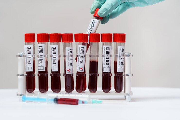 Rack of Tubes of blood sample for testing biological material