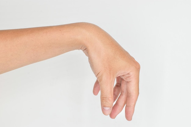 Photo radial nerve injury or wrist drop