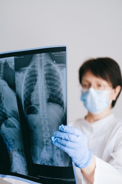 Foto radiografische uitmuntendheid transformeert de gezondheidszorg met röntgenstralen