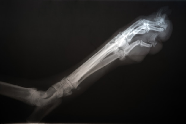 Radiography of a dog paw. Real x ray image of an injured dog paw.