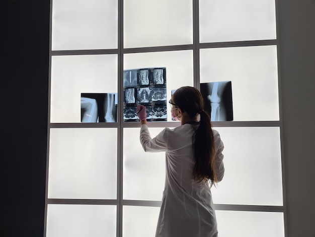 Фото Рентгенолог проверяет рентгеновское изображение на световом коробе