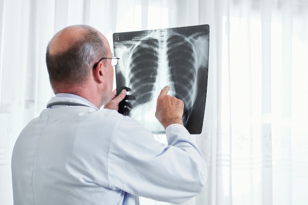 Radiologist examining lung x-ray