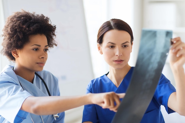 Foto concetto di radiologia, chirurgia, persone e medicina - dottoresse che guardano e discutono dell'immagine a raggi x in ospedale