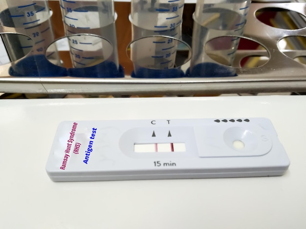 Ramsay Hunt Syndrome (RHS) testen met snelle testcassette in medisch laboratorium. resultaat positief