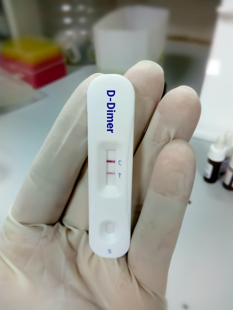 사진 d 이량체 검사용 신속 진단 카세트