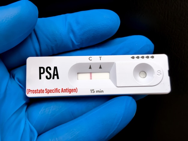 Rapid diagnostic test for PSA (Prostate Specific Antigen) with a negative result. Rapid test