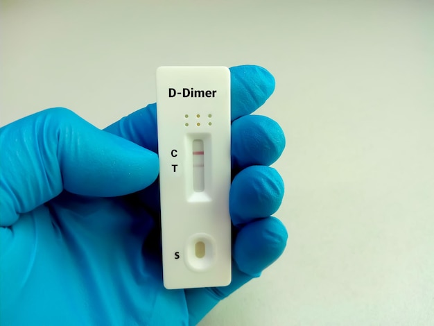 Photo rapid screening test for d dimer