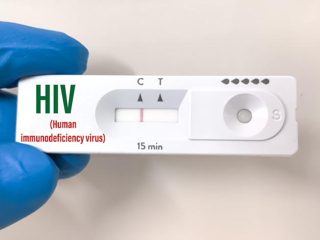 Rapid test cassette for HIV (human immunodeficiency virus) test at medical laboratory