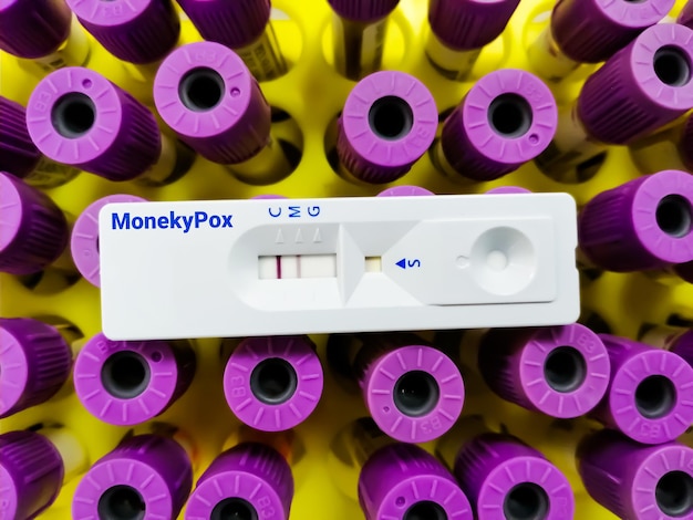 Monkeypox 바이러스 검사를 위한 신속한 검사 카세트