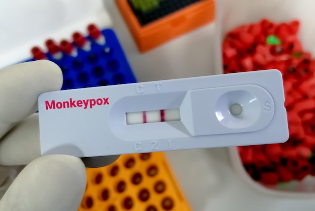 Monkeypox 바이러스 검사를 위한 신속한 검사 카세트