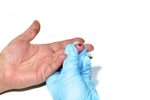 Photo rapid test for detecting hiv aids a red drop of blood falls into a test cassette for hiv detection