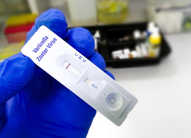 Foto dispositivo per test rapido o cassetta per virus varicella zoster o test vzv