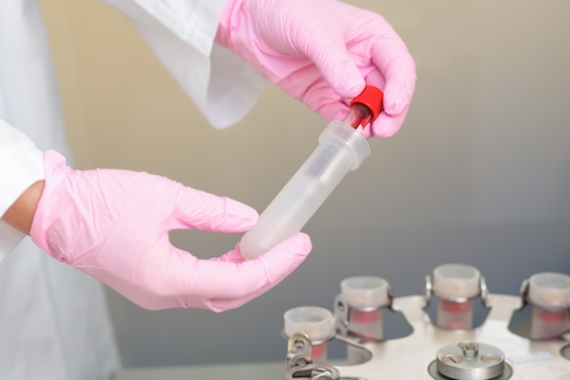 Foto reageerbuis met bloed in de hand van arts op centrifuge machine in medische kliniek, analyse door coronavirus.