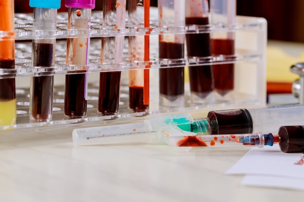 Reageerbuizen gevuld met bloed in laboratorium