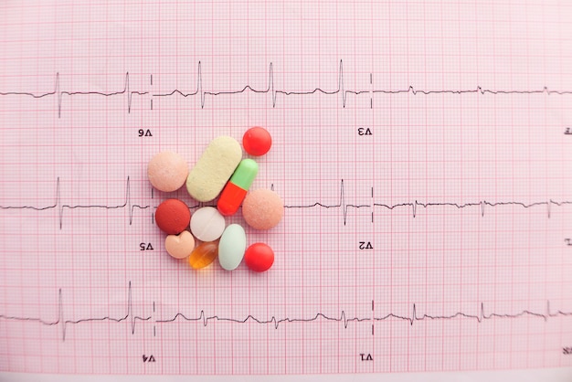 recept medische pillen op een cardio-diagram