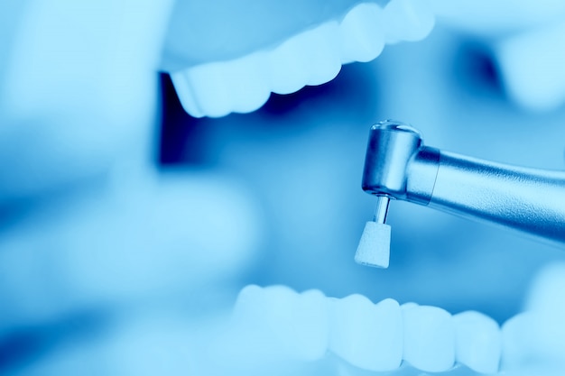 Photo a reception in the dentist's office, cleaning the enamel of teeth