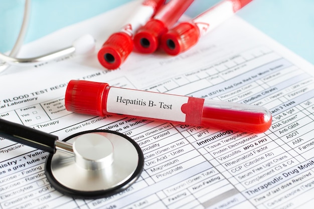 Red blood vial with blood sample for Hepatitis B test checking