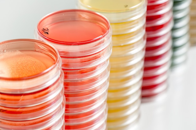 빨간색과 노란색 페트리 접시는 세균학 실험실 배경의 미생물학 실험실에 쌓입니다.