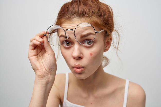 Redhaired woman wearing glasses pimple on face dermatology skin
care