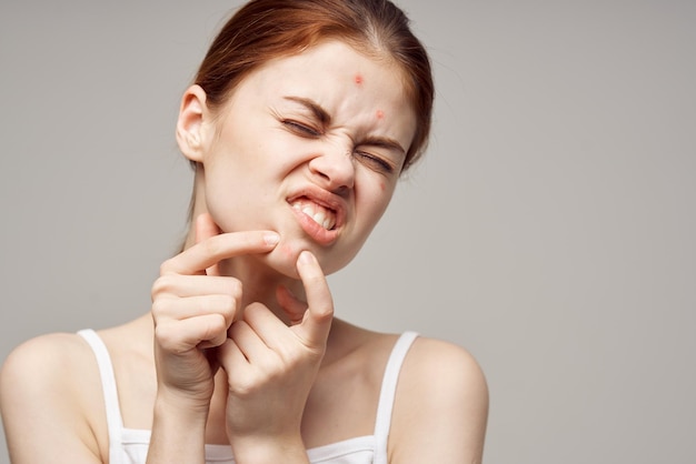 Redhaired woman with pimples on the face hygiene isolated\
background