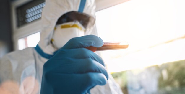 Photo researcher in protective clothing with test for covid19 positive with blood sample and antibody in the laboratory