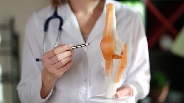 Rheumatologist points to anatomical model of human knee joint doctor recommendation and