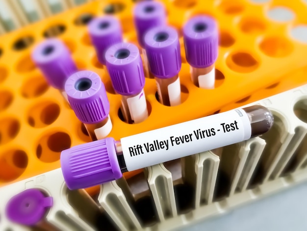 Foto rift valley fever-virustest, een rna-virus van de familie bunyaviridae, overgedragen door geïnfecteerde dieren