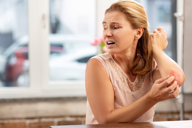 Rijpe aangename blondharige vrouw die zich ziek voelt met uitslag en krassen op het lichaam