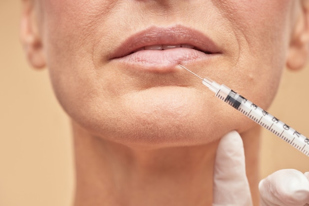 Rijpe vrouw die cosmetische injectie voor lippen doet