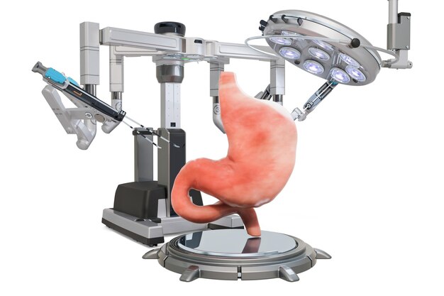 Robotic surgery of the stomach concept 3D rendering