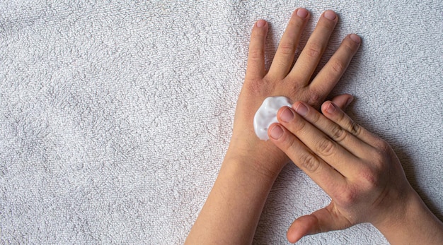 Rode vlekken op de huid van de handen van het kind Allergie van kinderenselectieve focusnatuur