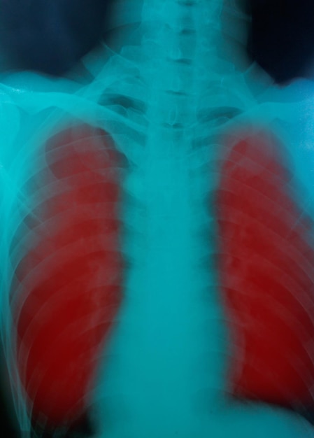 Foto röntgenfilm