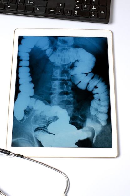 Foto röntgenfoto van de darm in de tablet het concept van telegeneeskunde en diagnose van ziekten