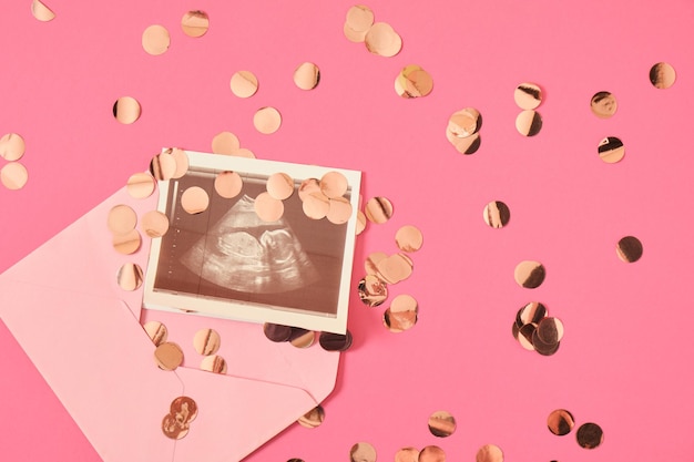 Roze envelop met een echo van een zwangere vrouw op een roze achtergrond