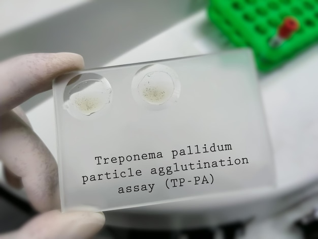 Treponema pallidum в рмп качественно