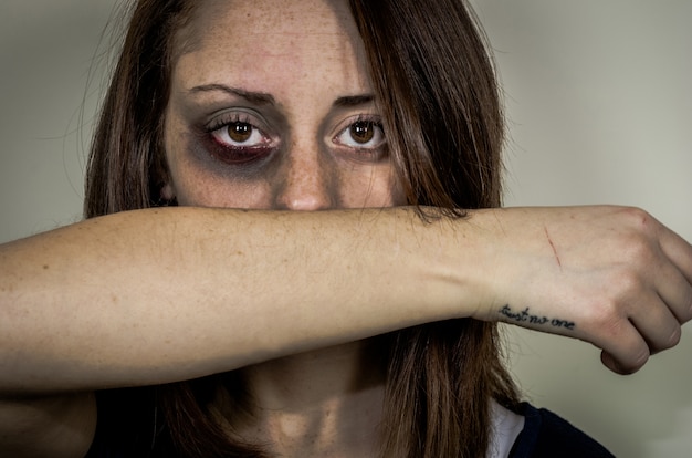 Sad beaten up girl with wounds on the face looking with deep look - caucasian people - concept about violence against women