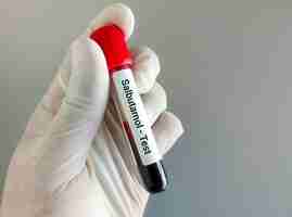 Photo salbutamol blood level testing a drug for copd