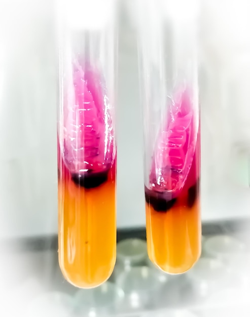 사진 미생물학 실험실에서 triple sugar iron tsi agar를 사용하여 salmonella 또는 shigella를 탐지하는 방법