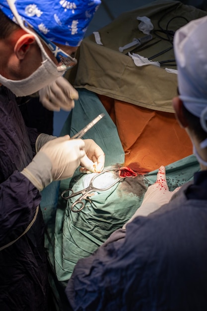 Photo samarkand uzbekistan february 25 2024 neurosurgeon doing surgery operation theater subdural hematoma in the brain multiple neurosurgeon open brain surgery1
