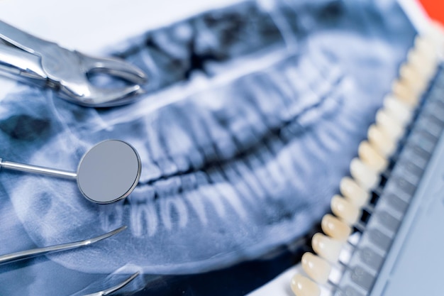 Samenstelling van röntgenfoto en tandartsapparatuur en rij tanden Close-up