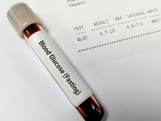 sample tube of Plasma glucose Fasting test with abnormal report called hypoglycemia