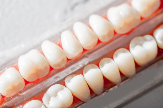 Samples of human teeth dental equipment