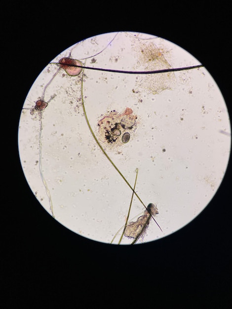 Photo scabies notoedres egg under the microscope