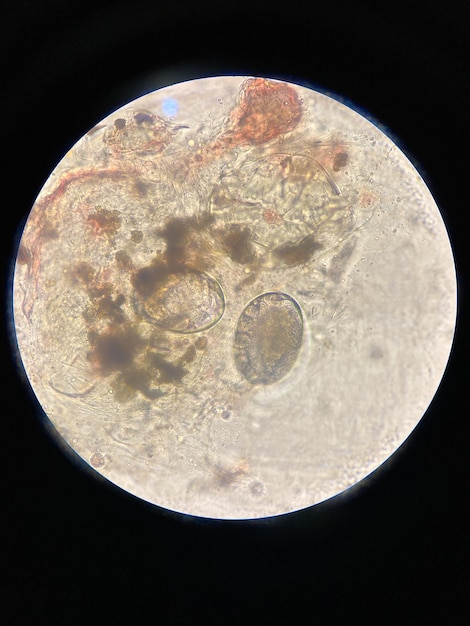 Foto scabies notoedres ei onder de microscoop