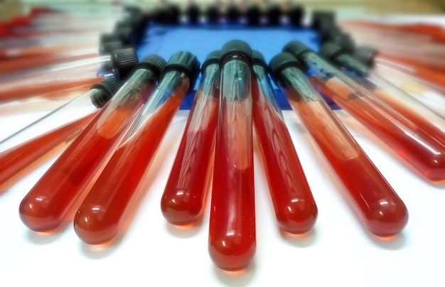 Schapenbloed in glazen buis na autoclaveren en klaar voor gebruik als bloedagar-media in de microbiologie