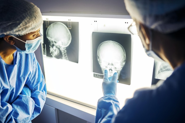 Schedel röntgen scherm en arts met analyse van scan gezondheidszorg en chirurgie met medisch team en neurologie Radiologie beoordeling en plan met mensen in het ziekenhuis chirurg en geneeskunde met anatomie